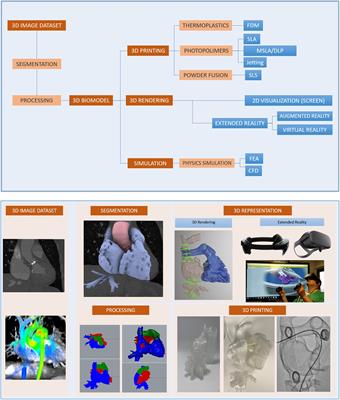 3D Virtual modelling, 3D printing and extended reality for planning of implant procedure of short-term and long-term mechanical circulatory support devices and heart transplantation